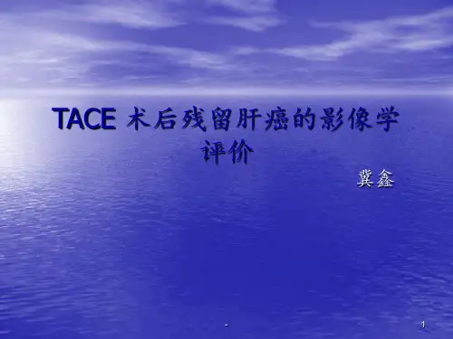 TACEppt课件