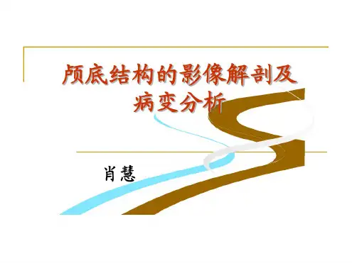 颅底结构的影像解剖及病变分析-+肖慧