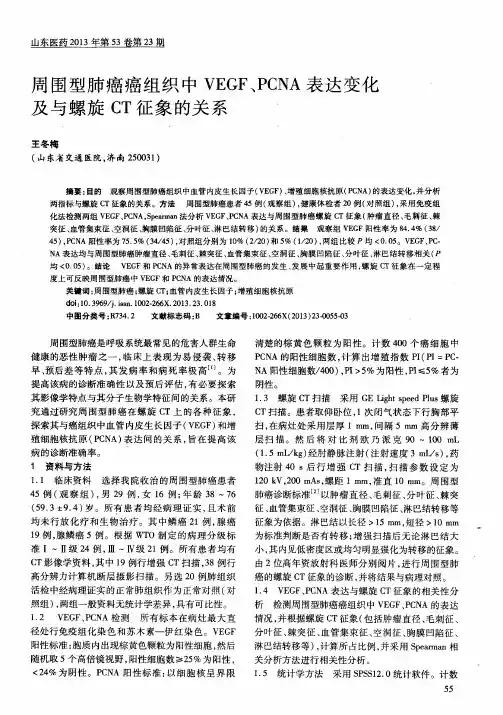 周围型肺癌癌组织中VEGF、PCNA表达变化及与螺旋CT征象的关系