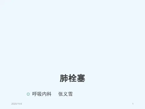 肺栓塞指南解读