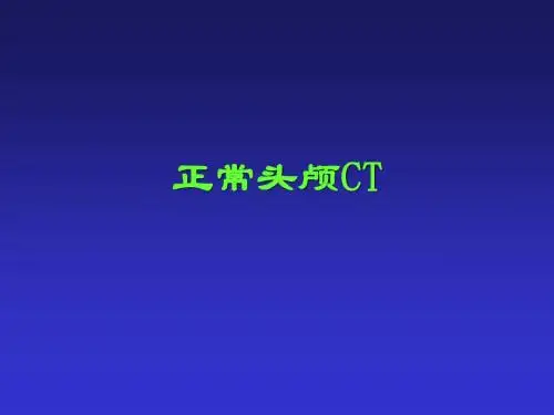 正常头颅CT
