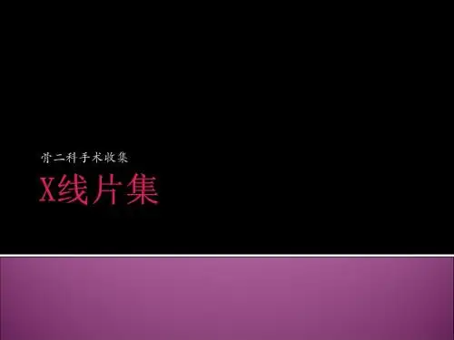 爱爱医资源-X线片集