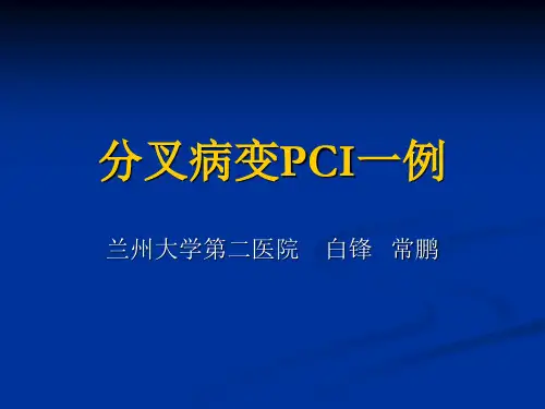 分叉病变SKS技术