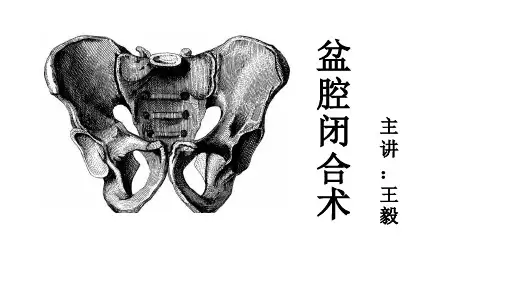 盆腔闭合术