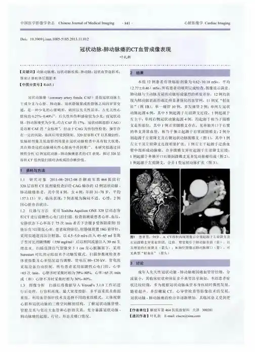 冠状动脉-肺动脉瘘的CT血管成像表现