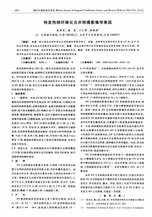 特发性肺纤维化合并肺癌影像学表现