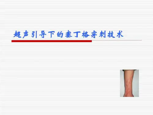 超声引导下的塞丁格穿刺技术_39页PPT