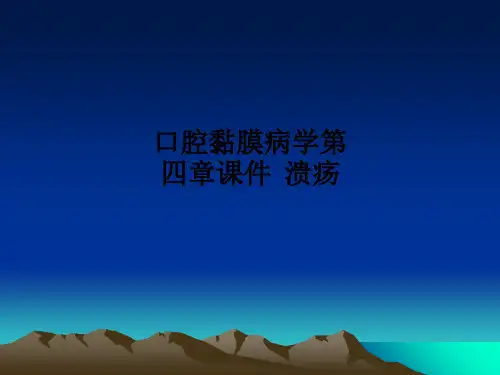 口腔黏膜病学第四章  溃疡PPT课件