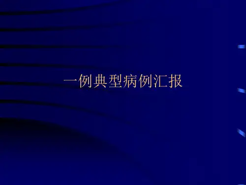 胫骨后髁撕脱骨折合并后交叉韧带损伤