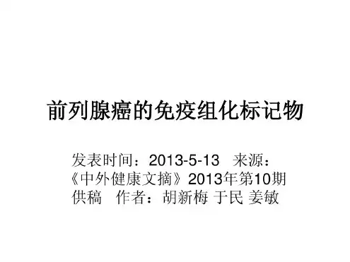 前列腺癌方面免疫组化基础知识