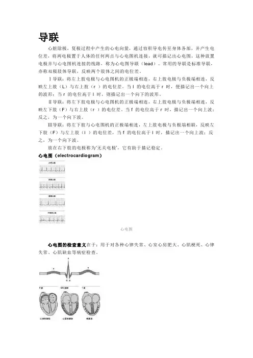 导联