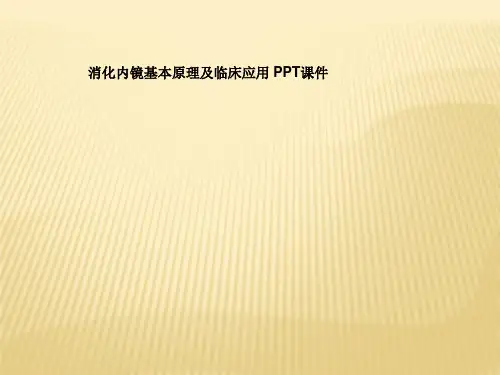 消化内镜基本原理及临床应用 PPT课件