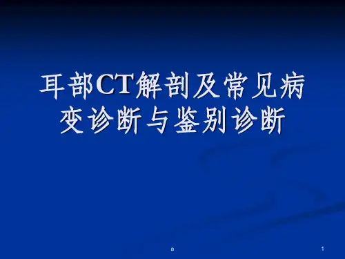 耳颞部解剖及常见疾病诊断CT