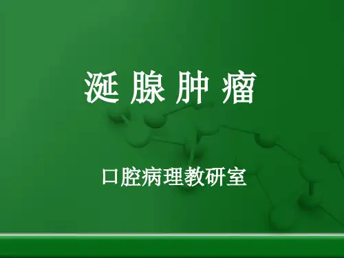 口腔组织病理学 :涎腺肿瘤