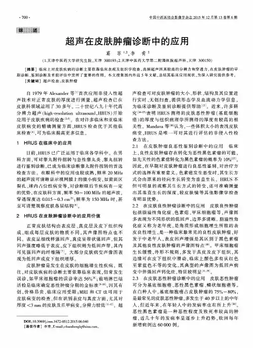 超声在皮肤肿瘤诊断中的应用
