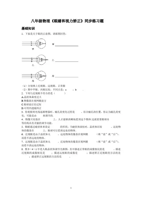 眼睛与视力矫正练习题