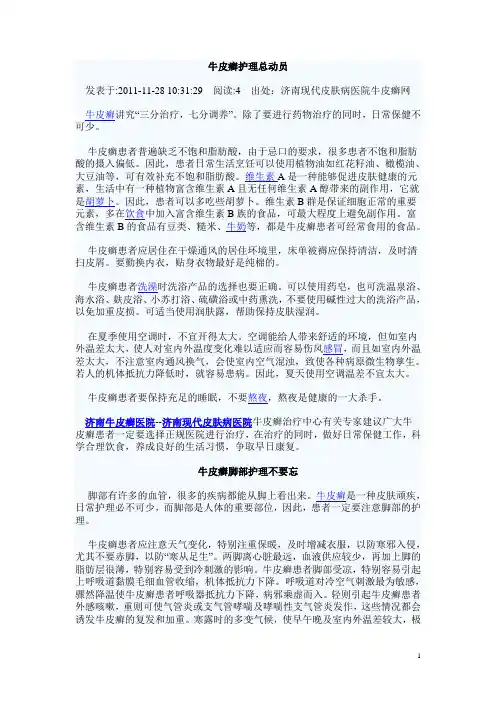 牛皮癣护理总动员