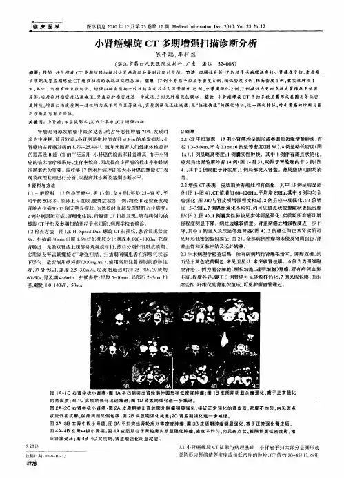 小肾癌螺旋CT多期增强扫描诊断分析