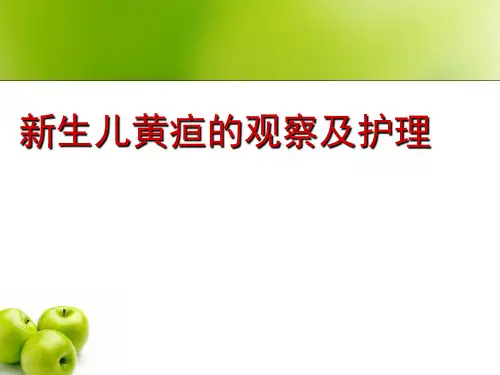 新生儿黄疸的观察及护理 ppt课件