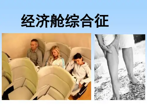 经济舱综合症
