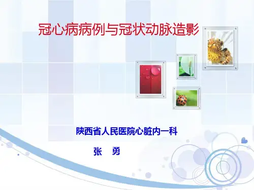 张勇 课件