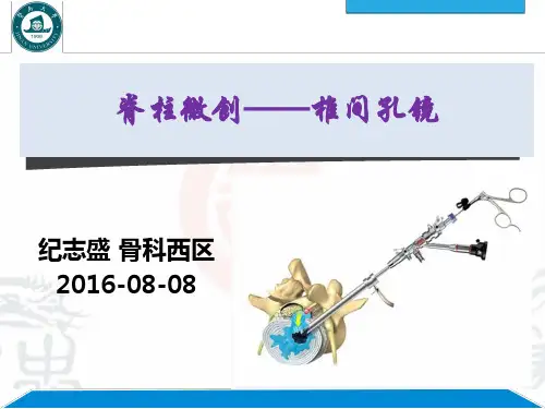 20160807小讲课 椎间孔镜