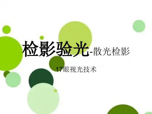 检影验光-散光