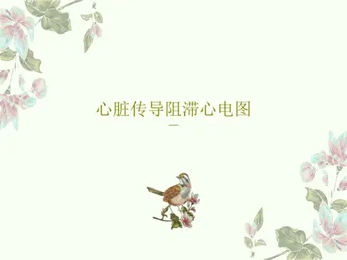 心脏传导阻滞心电图42页PPT