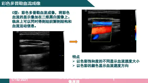 彩色多普勒超声成像原理培训课件