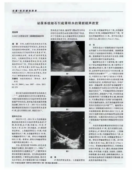 泌尿系统结石引起肾积水的肾脏超声改变