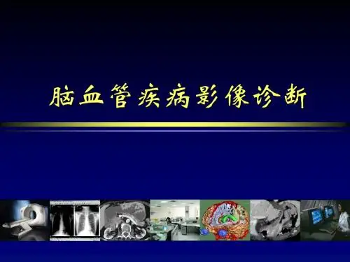 精品推荐医学影像诊断PPT课件图文详解完整版-脑血管疾病MRI诊断