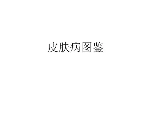 皮肤病图鉴
