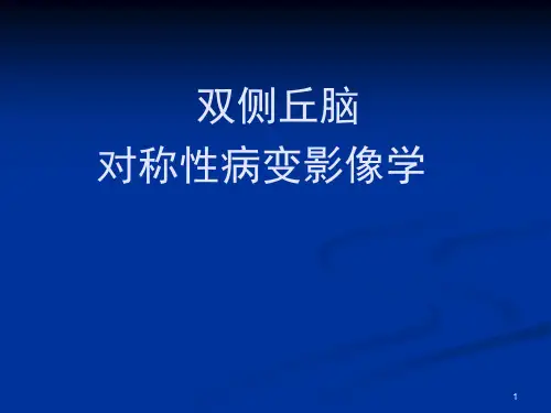 双侧丘脑对称性病变影像学PPT精选课件