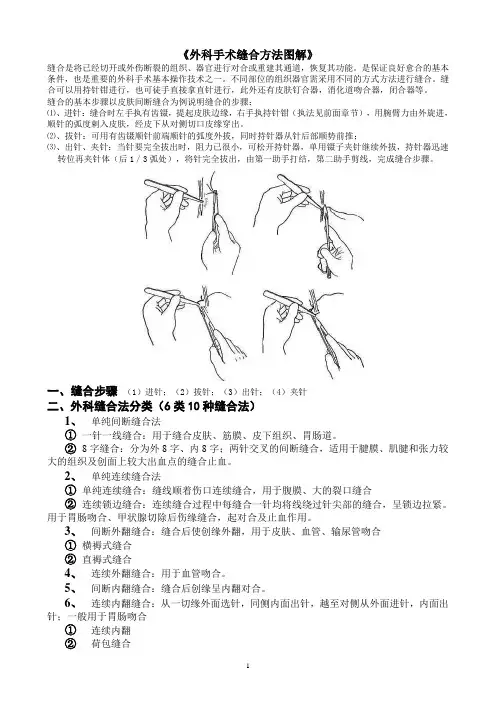 《手术缝合方法分类图解》