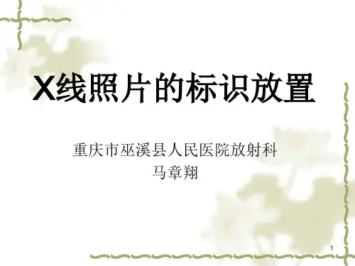 X线照片标识放置