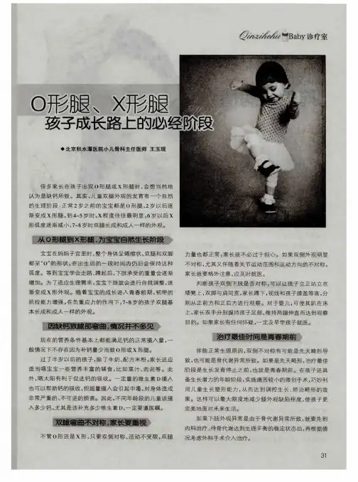 O形腿、X形腿 孩子成长路上的必经阶段