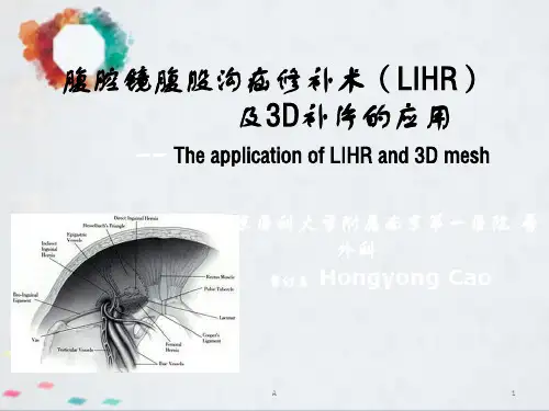 腹腔镜腹股沟疝修补术