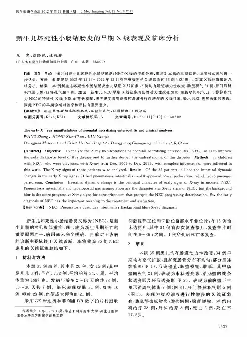 新生儿坏死性小肠结肠炎的早期X线表现及临床分析