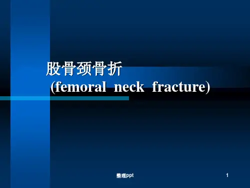 股骨颈骨折