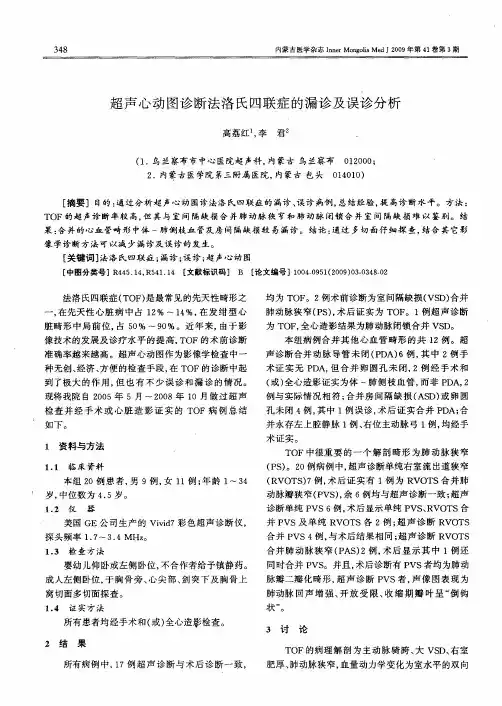 超声心动图诊断法洛氏四联症的漏诊及误诊分析