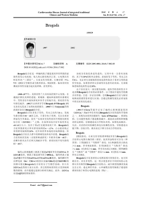 Brugada综合征的诊断及治疗