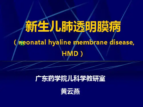 新生儿呼吸窘迫综合征