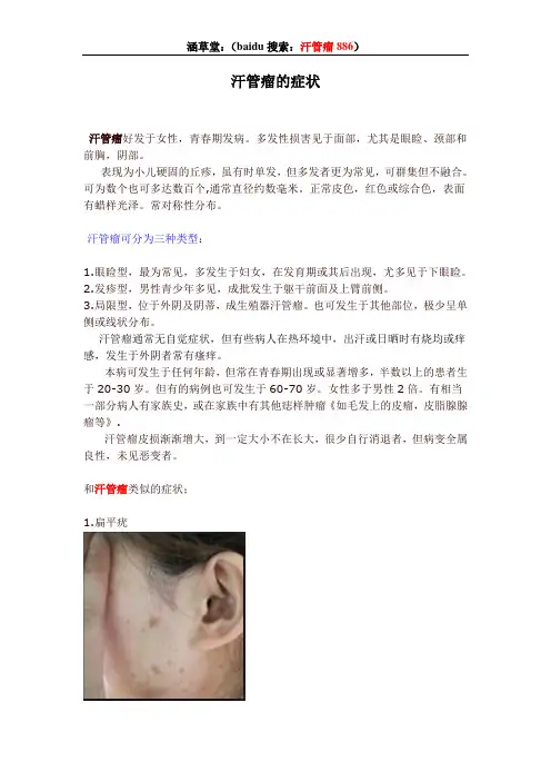 汗管瘤的症状