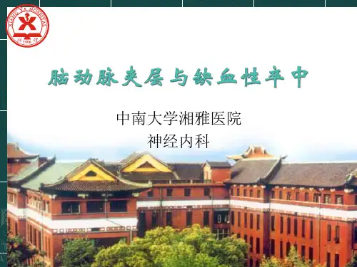脑动脉夹层与缺血性卒中