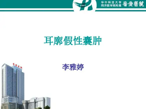 耳廓假性囊肿