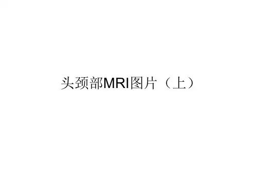 颅颈部MRI图片 (上)