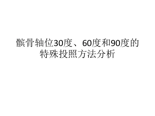 髌骨轴位30度、60度和90度的特殊投照方法分析