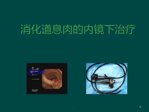 息肉PPT课件