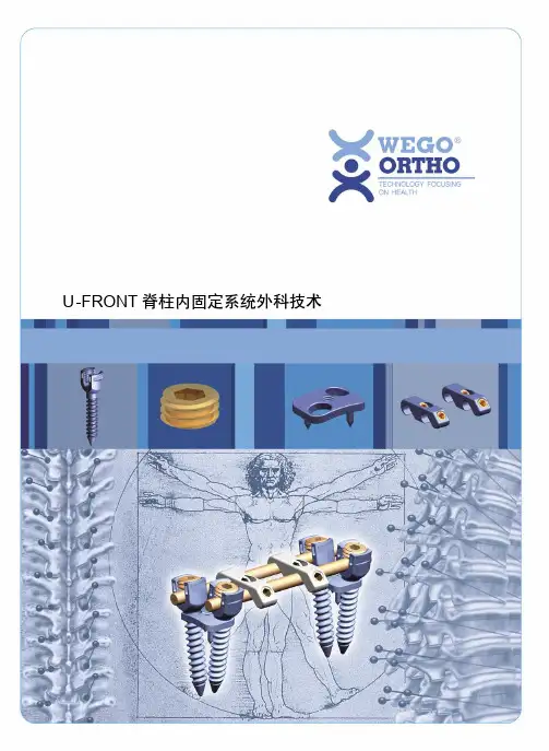UFRONT胸腰椎前路钉棒系统