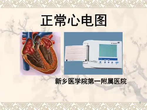 正常心电图31114